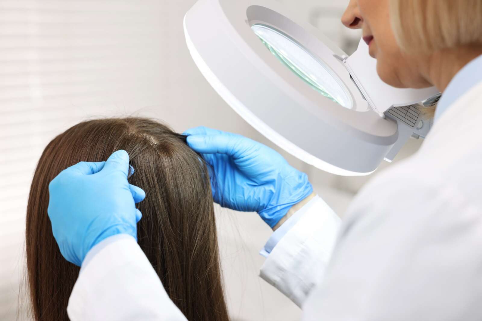 Hair Loss assessment at Ageless Beauty Surrey