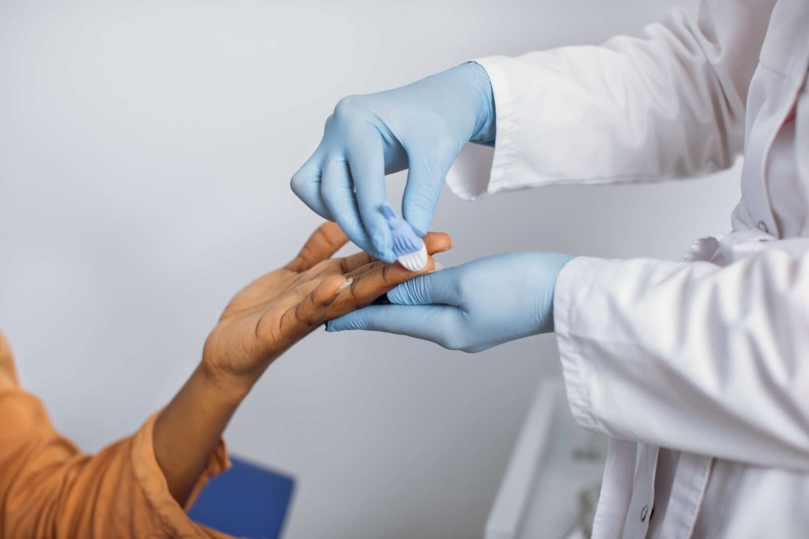 Treating warts in Surrey