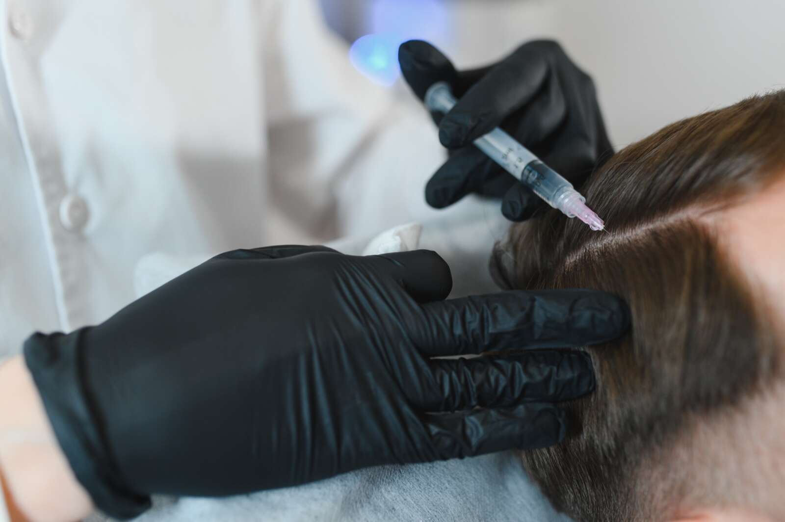 Hair Loss Treatment at Ageless Beauty Laser & Spa in Surrey