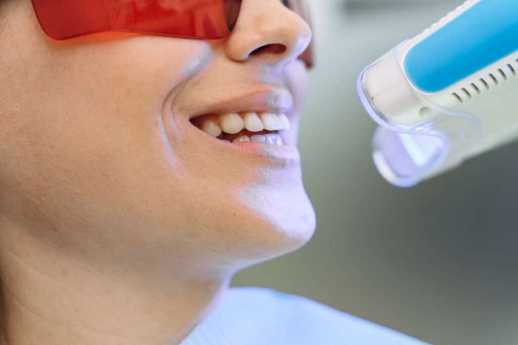 Teeth whitening treatment at Ageless Beauty Laser & Spa