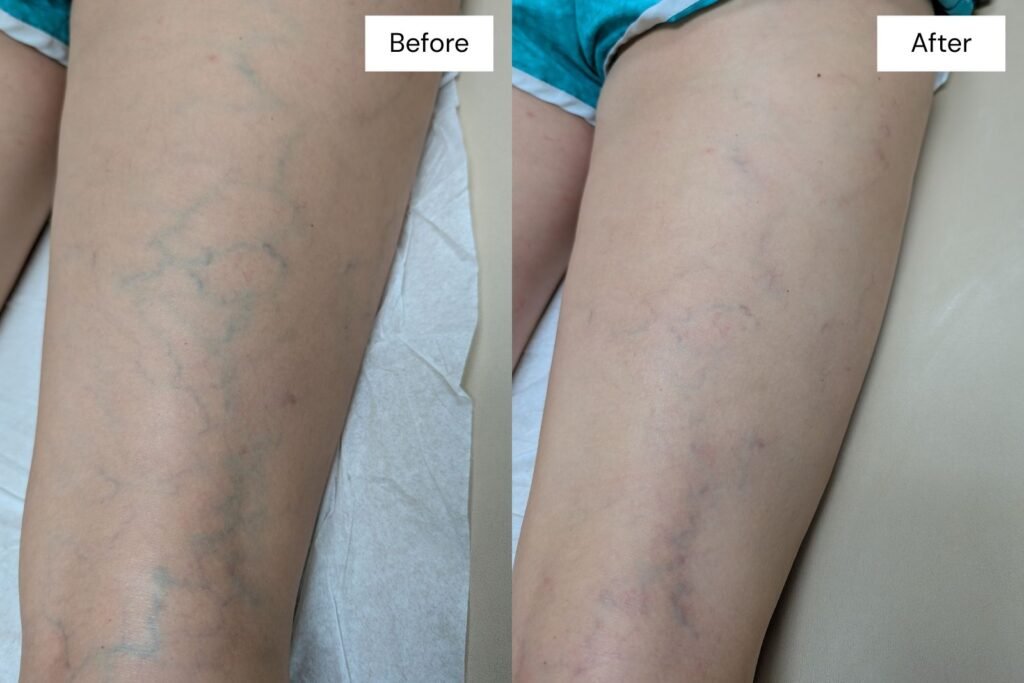 Your results before and after