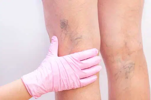 Target Areas at Ageless Beauty