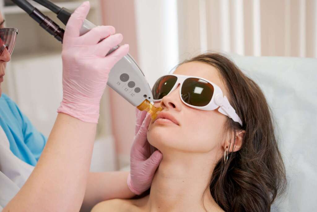 Facial laser treatment for visible veins at Ageless Beauty Laser & Spa